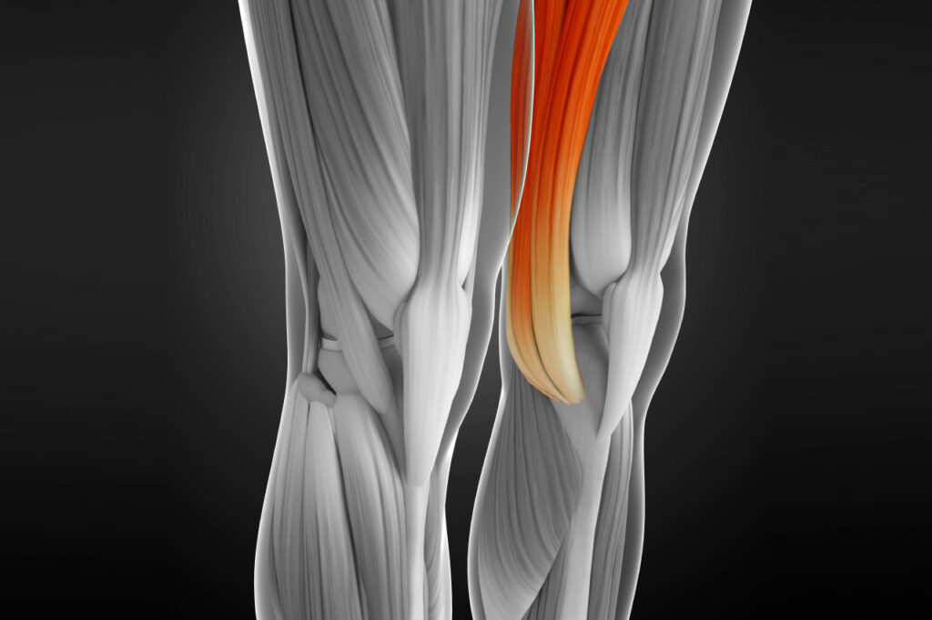 tendinitis-pata-ganso-tendiosis-bursitis-rodilla-correr-lesion-dolor-tendones-musculos