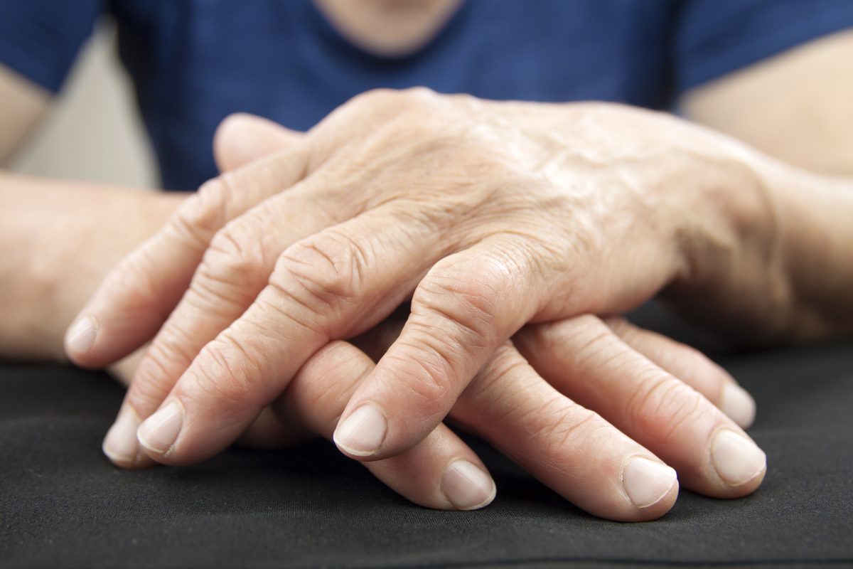 Artritis Reumatoide: sintomas y soluciones
